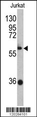 ZBTB2 Antibody