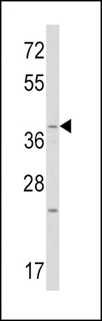 WNT1 Antibody