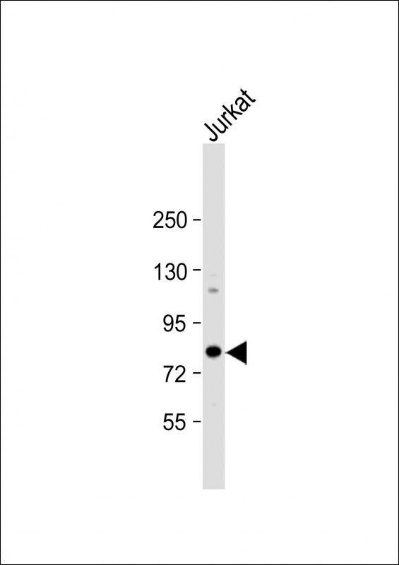 ALKBH8 Antibody