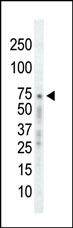 ADRBK1 Antibody