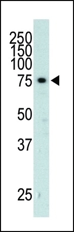 AD_K2 Antibody