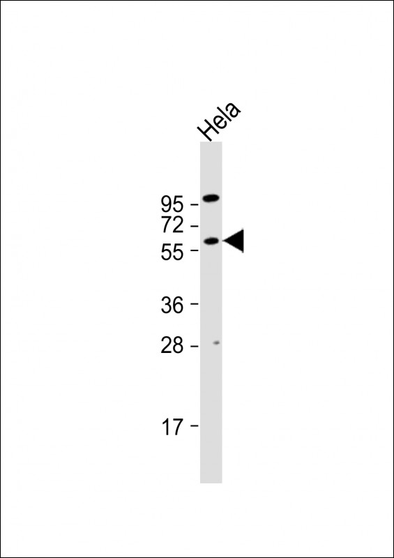 AKT2 Antibody