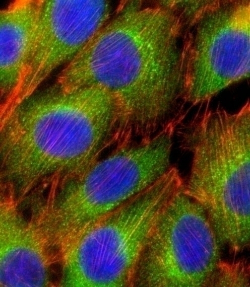 AKT2 Antibody