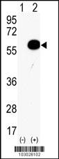 AKT2 Antibody