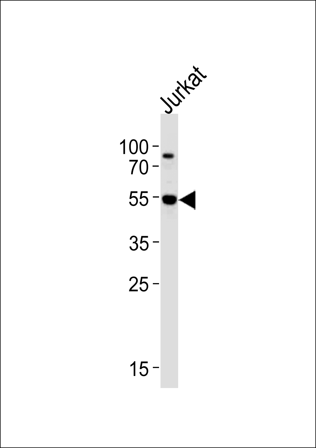 AKT3 Antibody