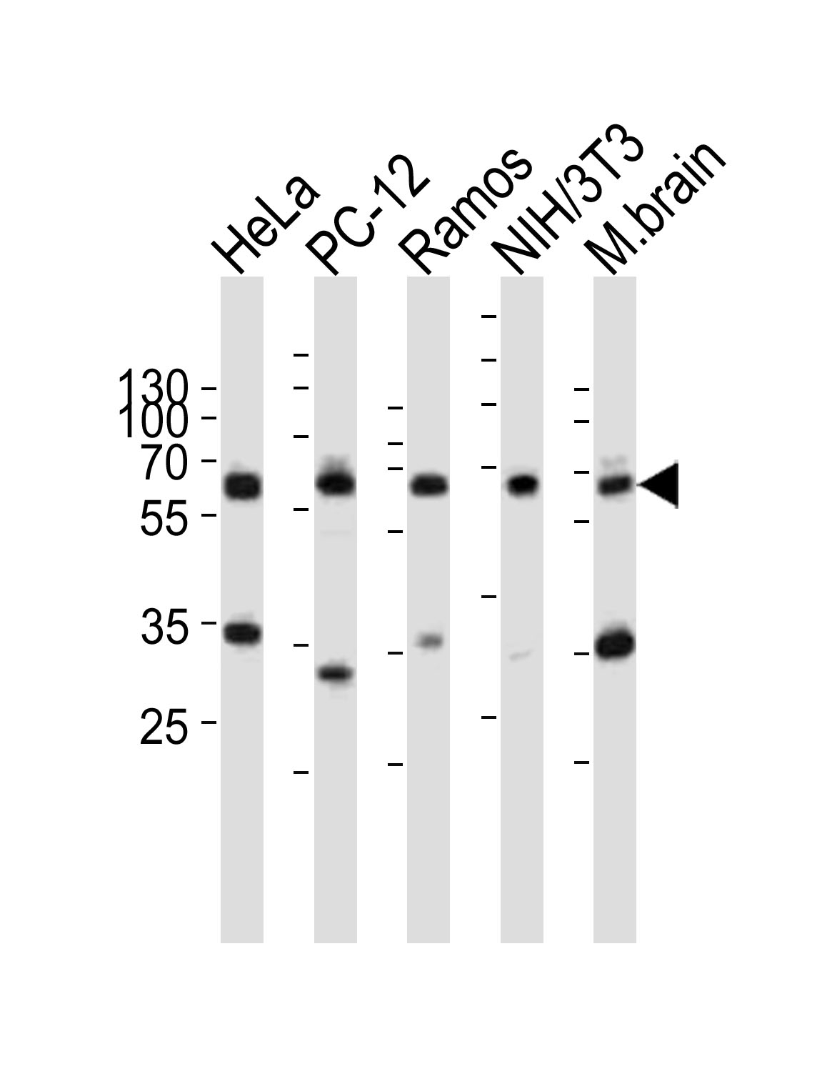 Pyruvate Kinase Antibody