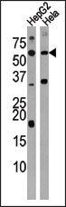 Activin A Receptor Type IC Antibody