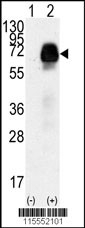 AMHR2 Antibody