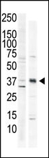 CAMK1 Antibody