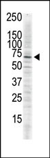 CAMK2D Antibody