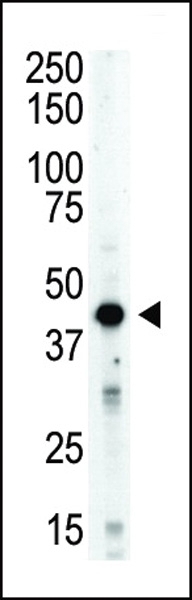 Aurora-B Antibody