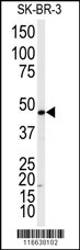 ADRB2 Antibody