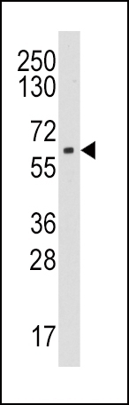 Aromatase Antibody
