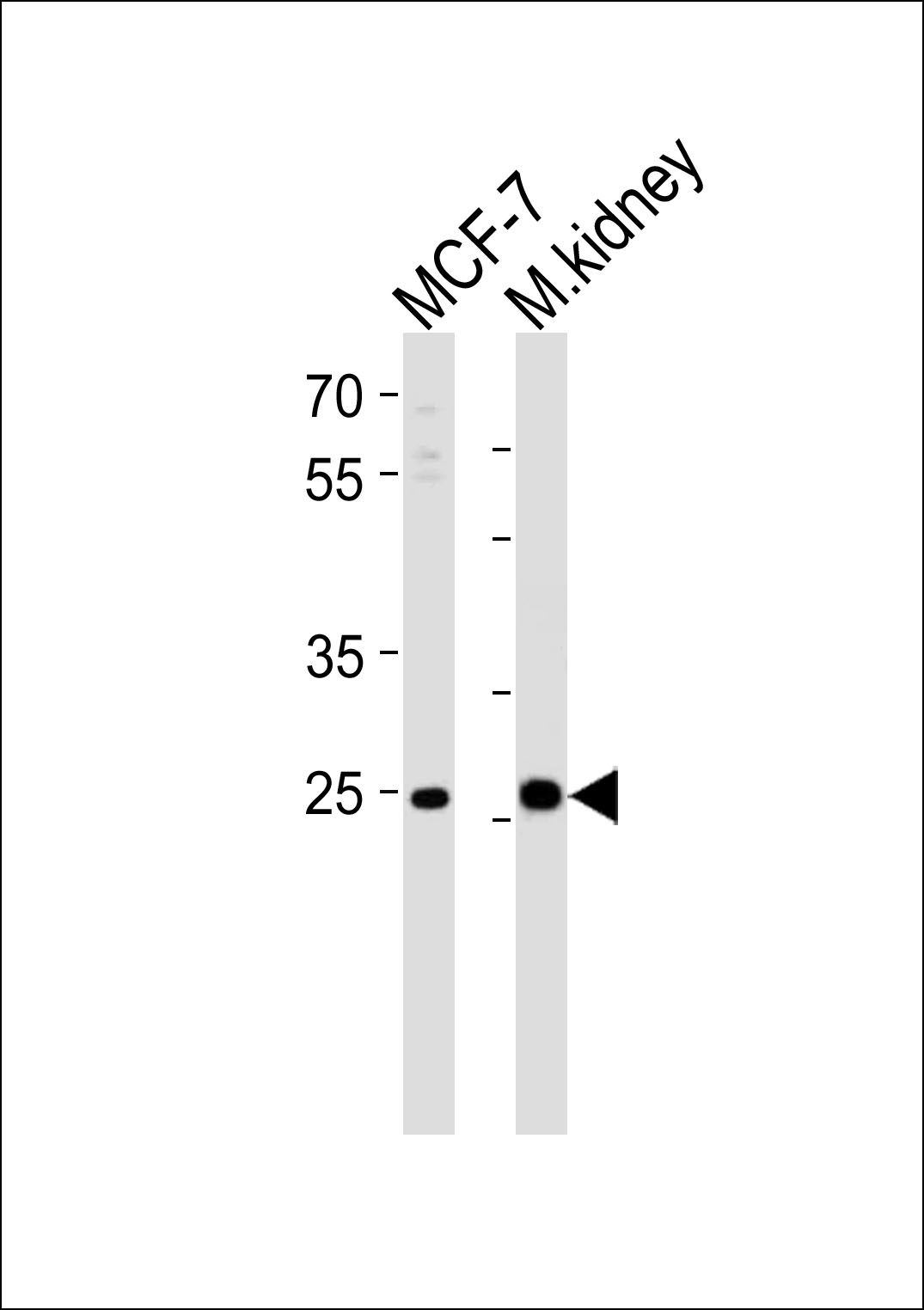 CA2 Antibody