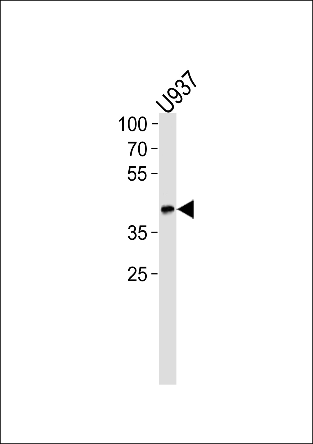 APOL1 Antibody