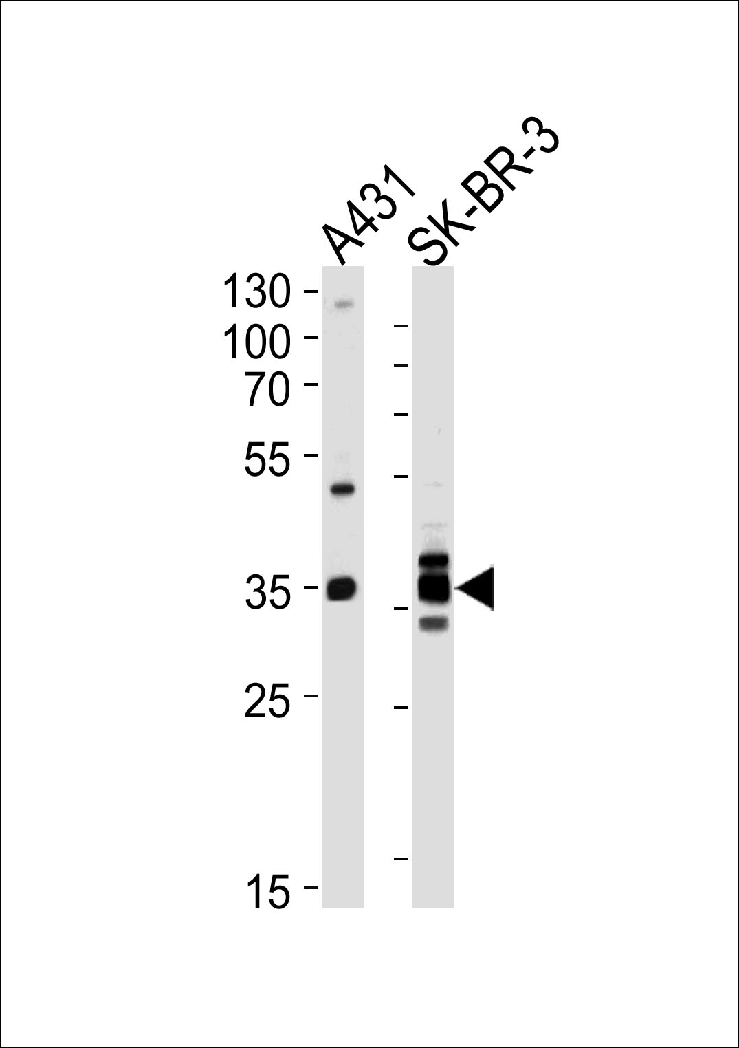 ANXA2 Antibody