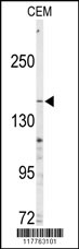 ABCC4 Antibody