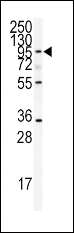 ADAMTS13 Antibody