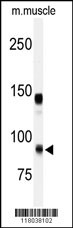 ADAMTS5 Antibody