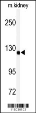 ADAMTS19 Antibody