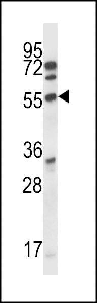 ALS2CR7 Antibody