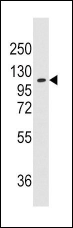 AlaRS Antibody
