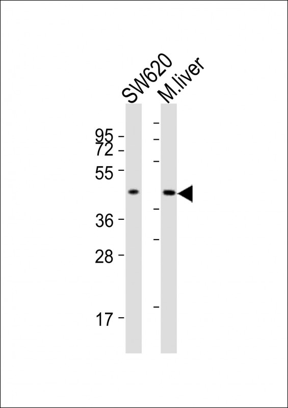 ACAT1 Antibody