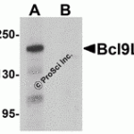 Western blot analysis of Bcl9L in HeLa cell lysate with Bcl9L antibody at 1 μg/mL in (A) the absence and (B) the presence of blocking peptide.