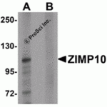 Western blot analysis of ZIMP10 in K562 cell lysate with ZIMP10 antibody at 0.5 µg/mL in (A) the absence and (B) the presence of blocking peptide.