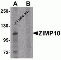 ZIMP10 Peptide