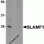 Western blot analysis of SLAMF1 in rat colon tissue lysate with SLAMF1 antibody at 1 μg/mL in (A) the absence and (B) the presence of blocking peptide.