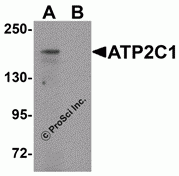 ATP2C1 Peptide