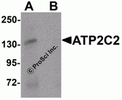 ATP2C2 Peptide