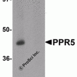 Western blot analysis of PRR5 in SK-N-SH cell lysate with PRR5 antibody at 1 μg/mL in (A) the absence and (B) the presence of blocking peptide.