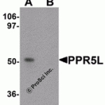 Western blot analysis of PRR5L in 3T3 cell lysate with PRR5L antibody at 1 μg/mL in (A) the absence and (B) the presence of blocking peptide.