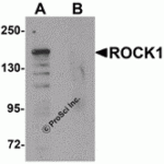Western blot analysis of ROCK1 in 293 cell lysate with ROCK1 antibody at 1 μg/mL in (A) the absence and (B) the presence of blocking peptide.