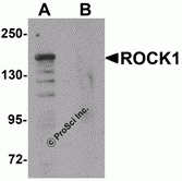 ROCK1 Peptide