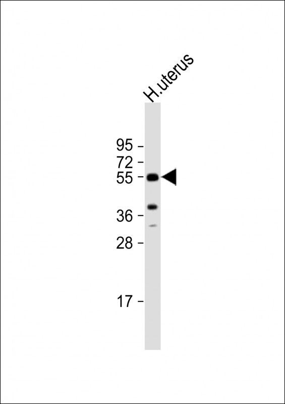 Aromatase Antibody
