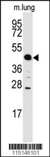 ACPP Antibody