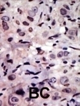 ALK Antibody