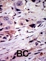 ALK Antibody