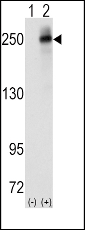 ALK Antibody