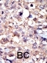 c ABL Antibody