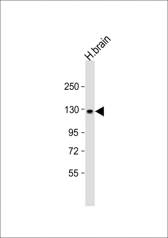 ACK1 Antibody