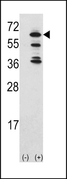 ACK1 Antibody