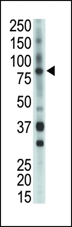 BMX Antibody