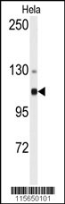 ACTN4 Antibody