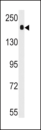 ACE Antibody