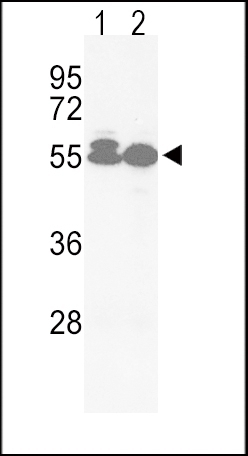 ACVRL1 Antibody
