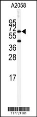 BCHE Antibody